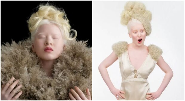 Porzucona przez krewnych dziewczyna albinos stała modelka: historia jest tylko do łez