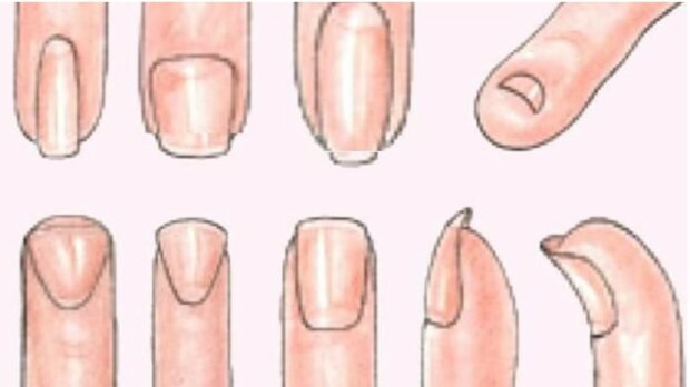 Kształt naszych paznokci jest jedną z oznak typu charakteru. To zadziwiające, jak możemy się różnić ze względu na tę cechę