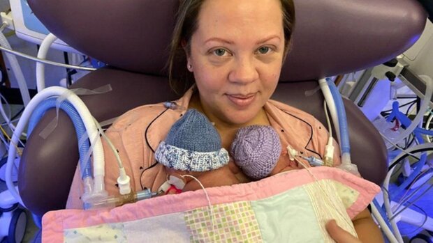Lekarze pomogli przeżyć dzieciom urodzonym w 22. tygodniu ciąży. Niezwykła historia